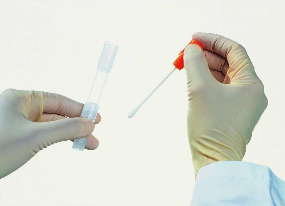 Sammeln von Tests zur Erkennung chronischer Prostatitis
