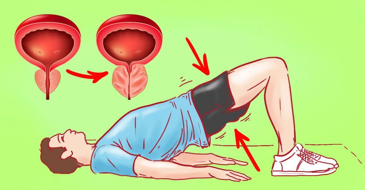 Therapeutische Übungen bei chronischer Prostatitis