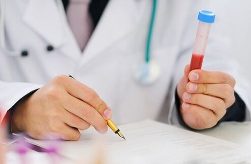 Tests auf Prostatitis für die Verschreibung von Medikamenten